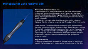 <span class=keywords><strong>ราคา</strong></span>เครื่องไมโครนีดเดิ<span class=keywords><strong>ล</strong></span> RF ยกกระชับผิว <span class=keywords><strong>ล</strong></span>ดรอยแผ<span class=keywords><strong>ล</strong></span>เป็นจากสิว 4 in 1 เครื่อง Fractional-RF-Microneedle-machine-price - Product Image 5