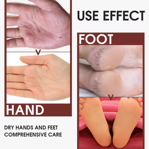 Crème Pédicure Pieds Antibactérienne Exfoliante et Hydratante, Soin Réparateur pour Talons Fissurés, Soin Ciblée des Pieds - Product Image 5