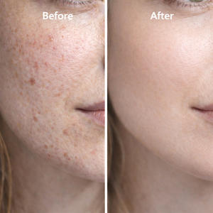 Sérum Visage Bio 30ml au Peptide de Cuivre, Acide Hyaluronique et Collagène pour Raffermissement et Réparation – Soin Essentiel pour la Peau - Product Image 3