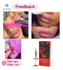 Plurvel – Meilleur <span class=keywords><strong>Prix</strong></span> – Remplisseur Lèvres Rouge 1ml avec <span class=keywords><strong>Injection</strong></span> de Vitamine B12 – Remplisseur Dermal Beauté Lèvres Rouges – Couleur Rosée Améliorée - Product Image 6