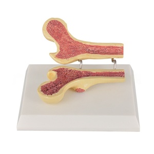 Modèle de fémur ostéoporotique-Comparaison de la densité osseuse transversale pour l'enseignement orthopédique et l'éducation gériatique - Product Image 5