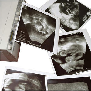 Imprimante vidéo Upp 110s Papier thermique à ultrasons 110 mm x 20 <span class=keywords><strong>m</strong></span> pour <span class=keywords><strong>Sony</strong></span> 110s - Product Image 5