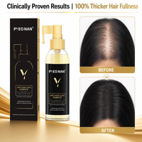 Sérum de traitement pour la croissance rapide des cheveux pour femmes et hommes, huile anti-chute de cheveux, sérum de repousse à base de plantes, marque privée, huile de biotine