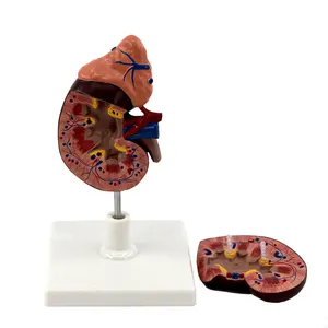 Medical Display Human Anatomy Kidney Model With Adrenal Gland For Anatomical Study