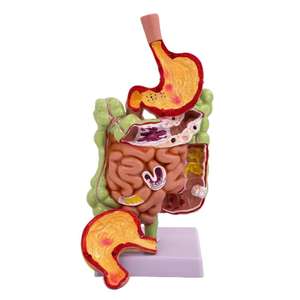 แบบจำลองการสอนทางการแพทย์ รุ่นลำไส้ใหญ่และโรคทางระบบทางเดินอาหาร - Product Image 4