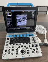 C57 4D 5D dernier système de diagnostic à ultrasons Doppler couleur numérique 4D 5D prix compétitif 6 langues échographie portable
