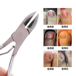 Stainless Steel Cuticle Nippers With Patterned Handle For Ingrown Toenail And Hangnail Removal <b>Nail</b> Care Tool - Product Image 1