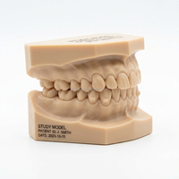 Modelo de Estudio Dental Personalizado para Alineadores SLA