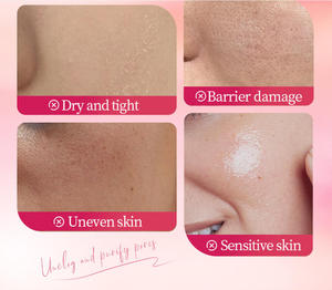 Limpiador Facial <span class=keywords><strong>de</strong></span> Fresa, <span class=keywords><strong>Limpieza</strong></span> Facial <span class=keywords><strong>Profunda</strong></span>, Control <span class=keywords><strong>de</strong></span> Grasa, Aclarante e Hidratante, Cuidado Facial, Venta al por Mayor, 100g - Product Image 2