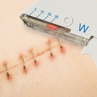 Agrafeuses cutanées manuelles jetables médicales, instrument de suture cutanée stérile portable pour la fermeture des plaies cutanées