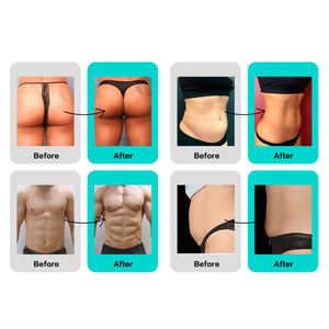 プロフェッショナルEMS筋肉増強マシン電子筋肉刺激装置筋肉リフティングHI-EMT 4ハンドルEMSZeroマシン - Product Image 6