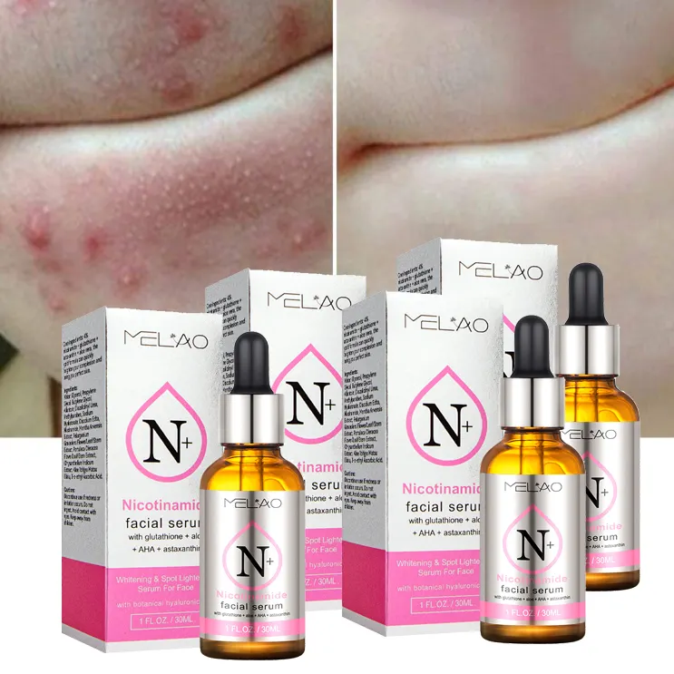 Private Label Custom Niacinamide Serum Whitening Light Spots Acne Shrink Pores Aloe Vera Astaxanthin Skin Care Serum