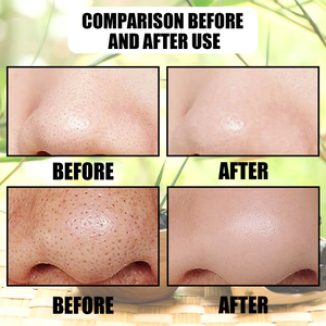 K loại bỏ mụn đầu đen mặt nạ 60ml Pull-off tre than mặt nạ sâu làm sạch mụn đầu đen bụi bẩn và làm sạch lỗ chân lông cho nam giới và phụ nữ - Product Image 3