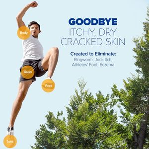 <span class=keywords><strong>ครีม</strong></span>แก้คันกลากเกลื้อนสำหรับมนุษย์ผิวหนังสำหรับแก้คันขี้กลากสำหรับนักกีฬารักษาเท้าผื่นคันผื่นคันบรรเทาอาการระคายเคือง - Product Image 5