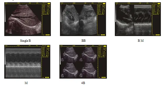 Hệ thống chẩn đoán siêu âm cầm tay y tế