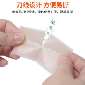 แผ่นซิลิโคนปิดแผลเป็น 4 ซม. x 2 ม. ระบายอากาศได้ สำหรับแผลเป็นเก่าและใหม่ แผลผ่าคลอด ดูแลแผลเป็น - Product Image 4