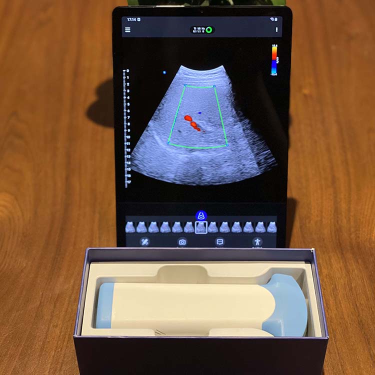 Sonda de monitoreo inalámbrica portátil digital sonda de ultrasonido inalámbrica sonda de ultrasonido para Android