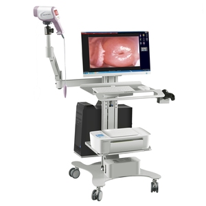 Kernel Medical Hospital Especializado Endoscopia Ginecologia Imaging System Trolley Colposcópio Óptico Digital KN-2200I(H) - Product Image 1
