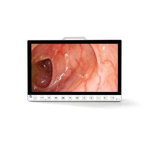 Sistema de Cámara de Endoscopia Portátil de 13.3 Pulgadas y 1080P con Grabador para Laparoscopia ENT TU-13.3DB, Cámara de Endoscopia Médica TU-13.3DB - Product Image 4