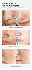 Máquina de Mesoterapia sin Agujas de Alta Presión, Pistola de Inyección de Suero Facial, Revitalización de la Piel, Equipo de Belleza Antiarrugas - Product Image 5