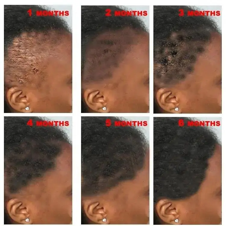 OEM 60ml Private Label Organic Formula Nourishing Scalp Elixirs Hair Care Loss Oil Treatment Hair Growth Serum