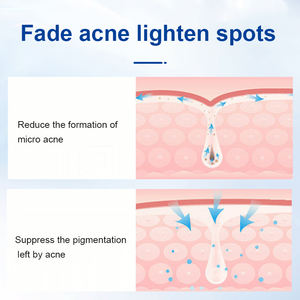 Dermvrije 180 Tabletten/Doos Waterdichte Acne Patch Onzichtbare Make-Up-Vriendelijke Hypoallergeen Voor Gevoelige Huid Vrouwelijke Hygiëne - Product Image 5