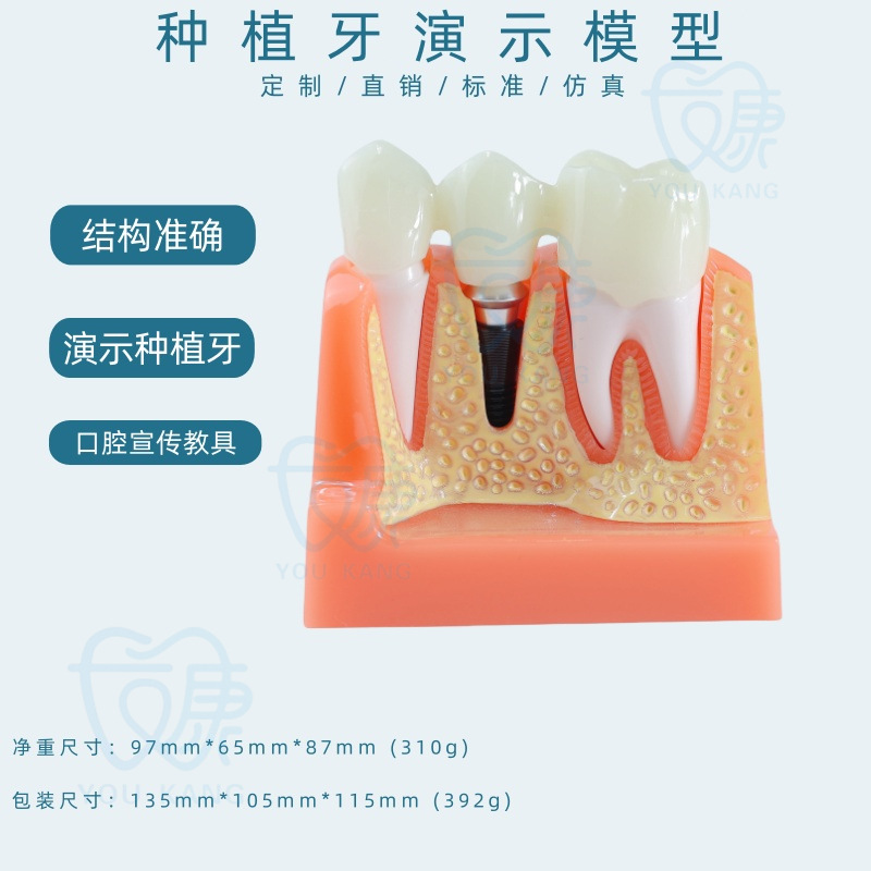 Implante dental C, fondo amarillo, clavo negro.