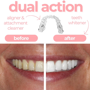 Espuma de limpieza personalizada de fábrica, limpiador profundo de efecto fuerte, blanqueamiento dental, eliminación de manchas, <span class=keywords><strong>Invisalign</strong></span>, aparatos dentales, Mousse - Product Image 2