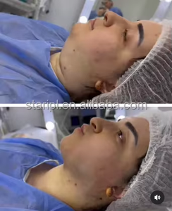 980nm 1470nm Diodo Láser Cuerpo Esculpir Lipólisis Reducción <span class=keywords><strong>de</strong></span> grasa Estiramiento facial Endolif Entrenamiento Liposucción La Serlipo Machine - Product Image 4