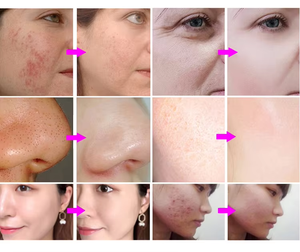 Máquina <span class=keywords><strong>de</strong></span> Hidrodermoabrasión 8 en 1, Máquina Facial <span class=keywords><strong>de</strong></span> <span class=keywords><strong>Belleza</strong></span> con Burbujas <span class=keywords><strong>de</strong></span> CO2, Peeling <span class=keywords><strong>de</strong></span> Diamante, Cuidado <span class=keywords><strong>de</strong></span> la Piel, Equipo <span class=keywords><strong>de</strong></span> <span class=keywords><strong>Belleza</strong></span> para Salón - Product Image 3