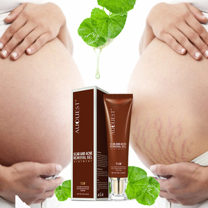 Crème réparatrice pour la peau, élimine les cicatrices, Gel des vergetures, Anti-acné, poudre naturelle, <span class=keywords><strong>visage</strong></span> en corée du sud, blanchiment de la peau, 1 pièce, TCM - Product Image 1