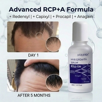 Sérum de repousse des cheveux RCP, cheveux clairsemés, booste la densité des cheveux, renforce les follicules pileux, formule non grasse à base d'eau, tous types de cheveux