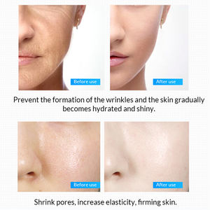 Meilleure vente de marque omy lady vegan soins de la peau visage anti-âge et hydratant microneedling sérum de corée - Product Image 4