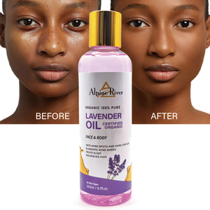 Aceite Corporal 100% Natural y Orgánico con Vitamina E, Elimina Manchas Oscuras, Elimina Ojeras, Ayuda a <span class=keywords><strong>Dormir</strong></span>, Aceite de Masaje de Lavanda - Product Image 1