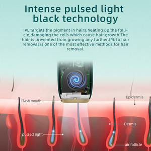 Ev kullanımı için taşınabilir Mini IPL epilasyon cihazı Mlay Mini cilt lazer saç epilatör - Product Image 2