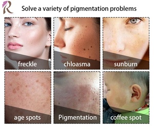 Máquina de Rejuvenecimiento Facial con <span class=keywords><strong>Plasma</strong></span> Vertical, Limpieza Profunda de la Piel, Antiarrugas, Dispositivo de Belleza para el Cuidado de la Piel - Product Image 3