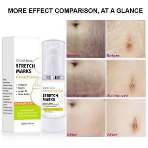 Private OEM Label Pregnancy SkincareMoisturizing Stretch Mark Cream With Probiotic Improving Skin Elasticity Stretch Mark Cream