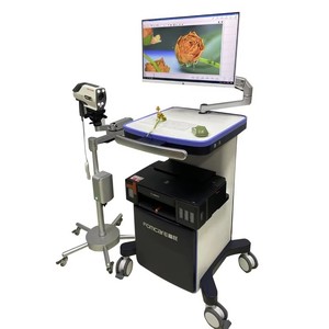 स्त्री रोग विज्ञान के लिए डिजिटल उच्च परिभाषा ट्रॉली कोपोस्कोप के लिए वीडियो कोलोपोस्कोपी उपकरण - Product Image 4