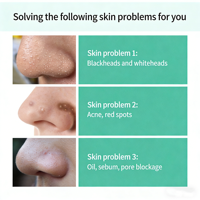 Patchs Hydrocolloïdes pour Points Noirs et Imperfections Nasales, Grandes Bandes Absorbantes pour l'Acné et les Impuretés du Visage, Utilisation Nocturne