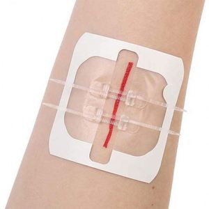 Medical Adhesive <b>Tape</b> for Injuries Swelling and Inflammation Hospitals - Product Image 4