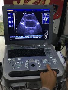 Ecógrafo Portátil de Alta Potencia con Doppler Color, Escáner de Ultrasonido Fetal 3D - Product Image 3
