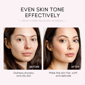 FENYI 100ml Correcteur Hydratant Quotidien à Base d'Eau pour l'Élimination des Taches Brunes avec Glycérine, Tonique Visage et Peau, Marque Privée - Product Image 6