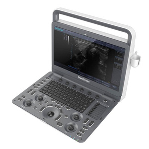 Appareil d'échographie vétérinaire portable et réutilisable Sonoscape E1V, niveau d'entrée, pour le diagnostic de base des petits animaux - Product Image 5