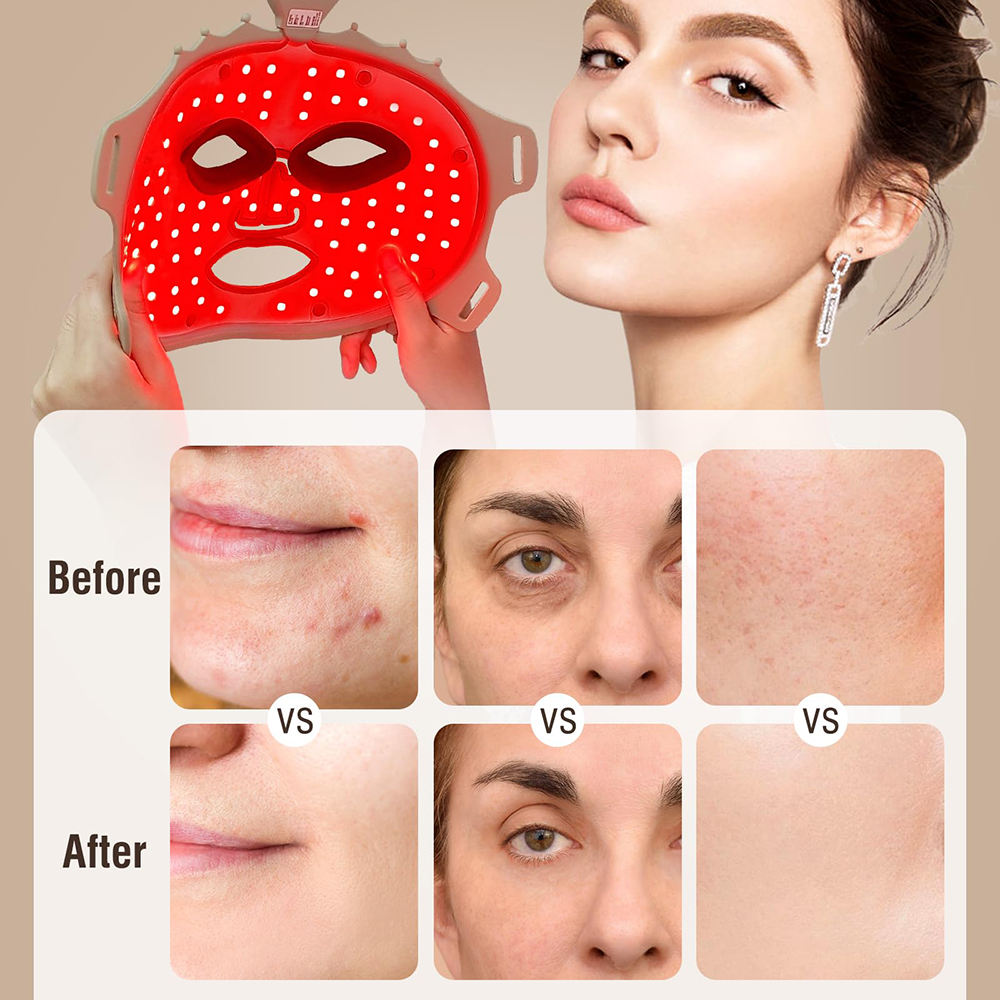 ORANGLES Professional LED Light Therapy Mask | Red Light Anti-Aging Facial Device for Skin Rejuvenation – orangles Qatar - elegant presentation - exhibiting components - Image 6 of 6 | ideal for home | Discount on Professional LED Light Therapy Mask | Red Light Anti-Aging Facial Device for Skin Rejuvenation – orangles Qatar Virginia | Free Shipping ORANGLES