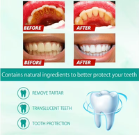 Pasta Dental con Probióticos de 100g para Eliminar Manchas, Mejorar el Mal Aliento, Accesorio Multiusos para Blanquear los Dientes, Precio al por Mayor