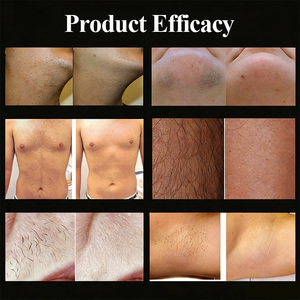 Appareil d'épilation pour la ligne du bikini, les aisselles, la <span class=keywords><strong>barbe</strong></span>, les lèvres, les poils du corps, blanchiment de la peau, réduction des pores, appareil de beauté, rajeunissement de la peau - Product Image 4