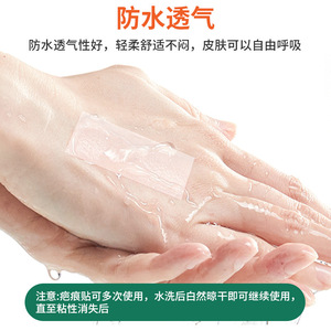 Patchs cicatrisants en gel de silicone, épaissis, lavables, pour brûlures et échaudures, tous types de peau, patch cicatrisant portable - Product Image 5