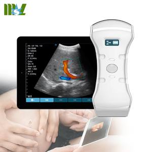 Garansi 2 tahun Ultrasonido 3 in 1 Ecografo portatel mesin <span class=keywords><strong>Ultrasound</strong></span> portabel dengan Probe <span class=keywords><strong>Ultrasound</strong></span> nirkabel - Product Image 1
