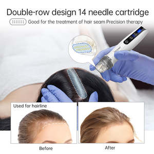 Kabelloser Elektro-Piercing-Stift Q2 mit Nadelspitze für das Gesicht – US-Stecker Gesichtsmassagegerät - Product Image 4