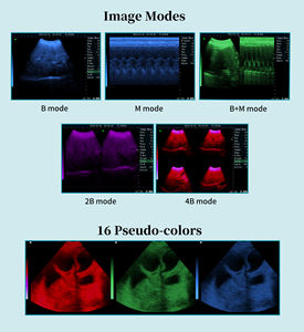 Mesin Peralatan USG Hewan Portabel 5,7 Inci dengan Probe Mekanis untuk Kehamilan Hewan - Product Image 4